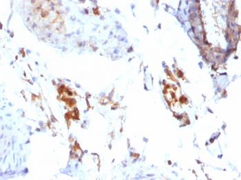 Ferritin, Light Chain (Node-Negative Breast Tumor Prognostic Marker) Antibody