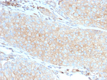 PD-L1 / PDCD1LG1 / CD274 / B7-H1 (Cancer Immunotherapy Target) Antibody