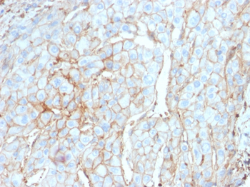 PD-L1 / PDCD1LG1 / CD274 / B7-H1 (Cancer Immunotherapy Target) Antibody