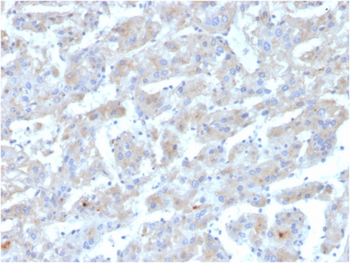 APOB Antibody