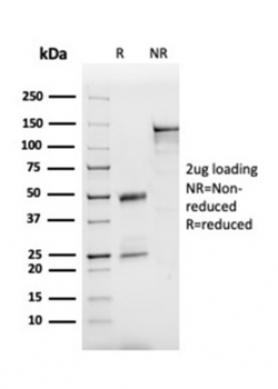 APOB Antibody