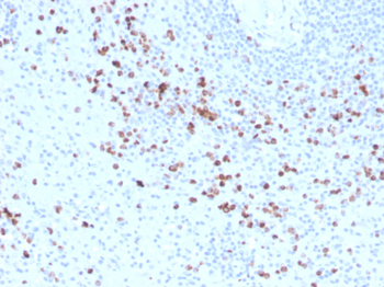 Granzyme B (NK/T-Cell Lymphoma Marker) Antibody