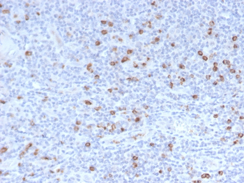 Granzyme B (NK/T-Cell Lymphoma Marker) Antibody