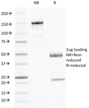 Interferon gamma (IFNG) Antibody