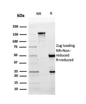 MME Antibody