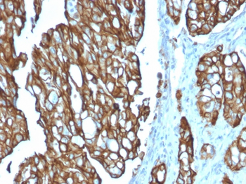 TACSTD2 / TROP2 (Epithelial Marker) Antibody