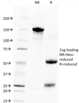 TACSTD2 / TROP2 (Epithelial Marker) Antibody