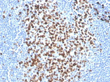 Ki-67 (Proliferating Cell Marker) Antibody