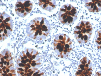 ITLN1 Antibody