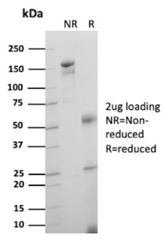 ITLN1 Antibody