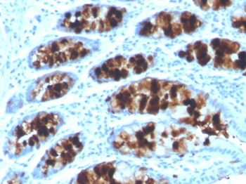 ITLN1 Antibody