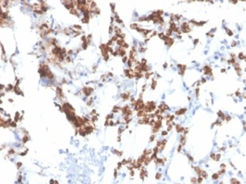 RETN Antibody