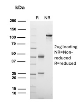 RBP4 Antibody