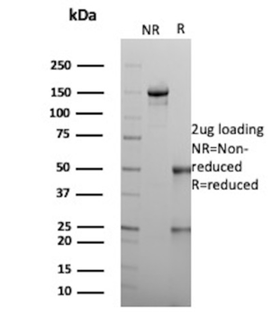 RBP4 Antibody
