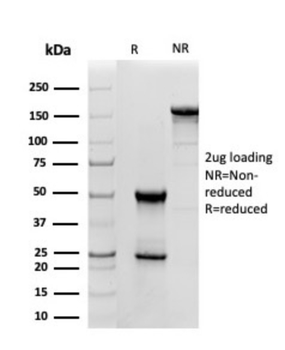 SOD1 Antibody
