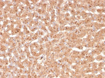 TTR Antibody