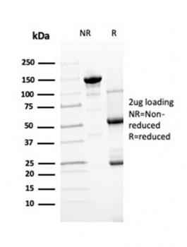 TTR Antibody