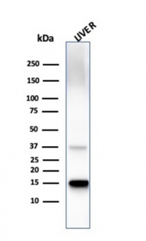 TTR Antibody