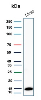 TTR Antibody