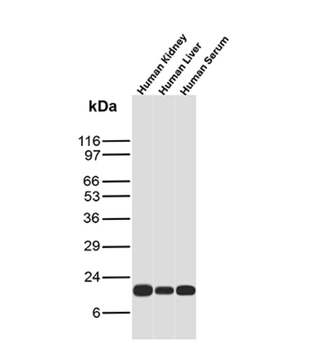 TTR Antibody