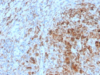 HAVCR2 Antibody