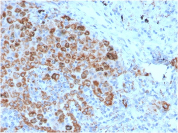 HAVCR2 Antibody