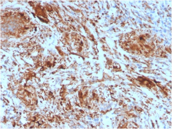 HAVCR2 Antibody