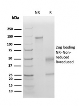 HAVCR2 Antibody
