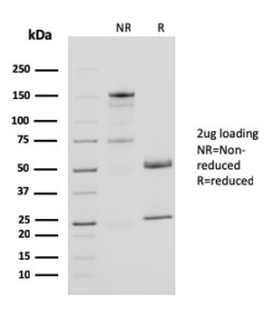 CD40 Ligand / CD154 / TRAP1 (Activation Marker of T-Lymphocytes) Antibody