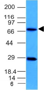 TOP1MT Antibody
