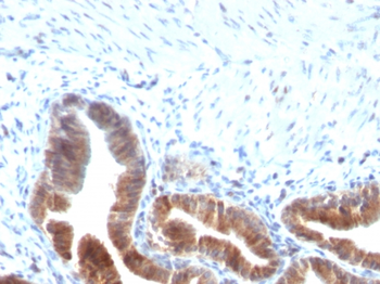 TOP1MT Antibody