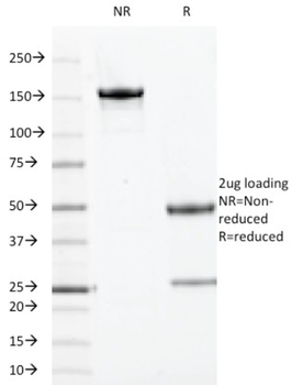 TOP1MT Antibody