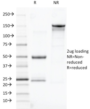 TOX3 Antibody