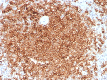 CSF2 Antibody