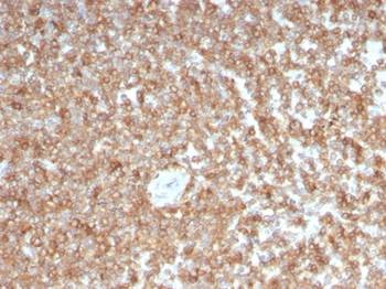 CSF2 Antibody