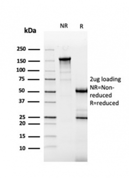 CA9 Antibody