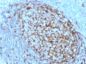 CSTA Antibody