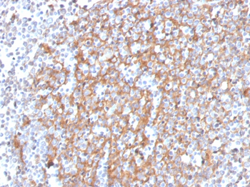 CSTA Antibody