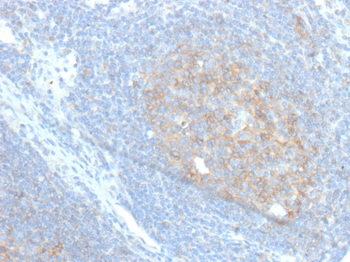 CD86 Antibody