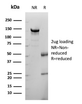 KLK5 Antibody