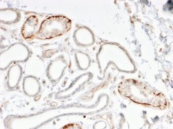 GTF2H2C, GTF2H2C_2 Antibody