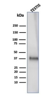 CLU Antibody