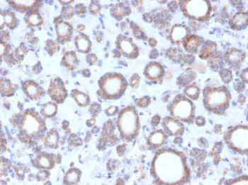 RHOBTB2 Antibody