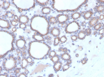 RHOBTB2 Antibody