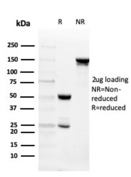 ITLN1 Antibody