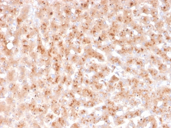 TTR Antibody