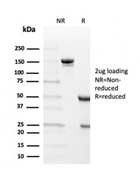 TTR Antibody