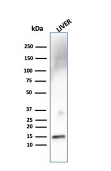 TTR Antibody