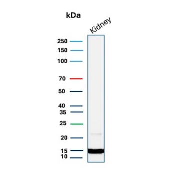 TTR Antibody