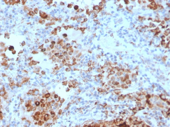 HAVCR2 Antibody